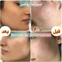 اموزش فیشال|خدمات آموزشی|مشهد, دانشجو|دیوار