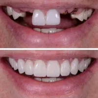 وام قرض الحسنه ۵۰۰ میلیونی دندانپزشکی و ایمپلنت