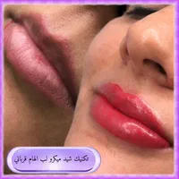 میکروبلیدینگ فیبروز شیدلب بنمژه ریموو|خدمات آرایشگری و زیبایی|شیراز, کوی زهرا|دیوار