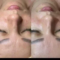 تاتو دائم، فیشیال، اسپا، کراتین،خالبرداری