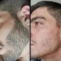 ریشت رو بسپار به معجزه رشد
