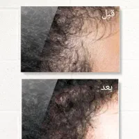 اکسیرپرپشتی مو ،مژه و ابرو|خدمات آرایشگری و زیبایی|گلبهار, شهر جدید گلبهار|دیوار