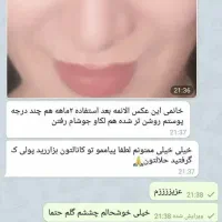 کرم  ضد لک و سفید کننده تضمینی|آرایشی، بهداشتی، درمانی|کیش, |دیوار