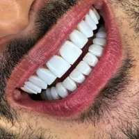 دندانپزشکی بدون پیش پرداخت عصب کشی . کامپوزیت و...|خدمات آرایشگری و زیبایی|قم, عمار یاسر|دیوار