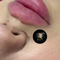 .تخفیف. تزریق ژل فیلر بوتاکس انزیم تضمینی پرسینگ