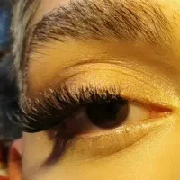 کاشت مژه هیدن