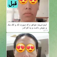 پوست کره ای|خدمات آرایشگری و زیبایی|ارومیه, |دیوار