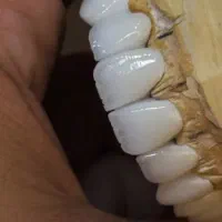 آموزش پودر (پرسلن) گذاری لایرینگ