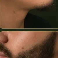 با ریش مردونه تر و خوشتیپ تر باش