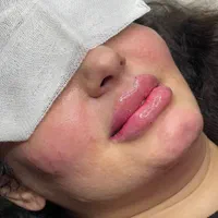 خدمات ژل عربی ‌خلیجی زیبادرکلینیک|خدمات آرایشگری و زیبایی|پرند, فاز ۵|دیوار