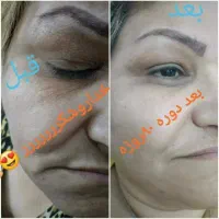 پوست زیبا و بدون آرایش|آرایشی، بهداشتی، درمانی|اهواز, منازل کارون|دیوار