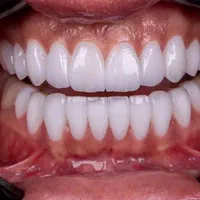 خدمات دندانپزشکی قرارداد با کوثر،البرز،آسیا،سینا