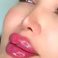 ژل لب و مادلینگ 450 هزارتومان توسط پزشک کلینیک