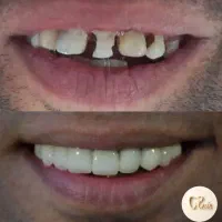 دندان پزشکی