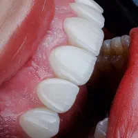 منشی خانم مجرد در دندانپزشکی