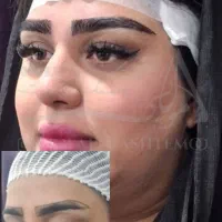 کاشت ابرو تخصصی در درمانگاه معتبر|خدمات آرایشگری و زیبایی|اهواز, زیتون کارمندی|دیوار