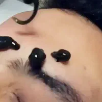 خدمات طب سنتی در محل و کلینیک