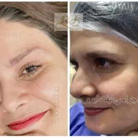تخفیف و مشاوره جراحی زیبایی صورت و لیپو شکم|خدمات زیبایی و سلامت|تهران, ستارخان|دیوار