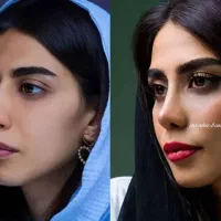 عمل و جراحی بینی 23تا25 میلیون /مشاوره رایگان|خدمات آرایشگری و زیبایی|کرج, عظیمیه|دیوار