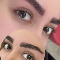 میکرو پگمتیشن با قیمت استثنایی فقط به مدت ده روز