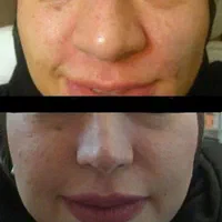 انزیم بینی|خدمات آرایشگری و زیبایی|الشتر, |دیوار