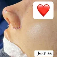 عمل های زیبایی توسط پزشک متخصص با مناسبترین قیمت|خدمات آرایشگری و زیبایی|اهواز, کیانپارس |دیوار