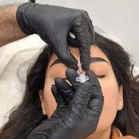 لیزر موهای زائد بانوان آقایان ژل بوتاکس/جنت اباد|خدمات آرایشگری و زیبایی|تهران, جنت‌آباد جنوبی|دیوار