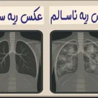 مشاوره طب سنتی برای مشکلات تنفسی|خدمات آرایشگری و زیبایی|رفسنجان, |دیوار