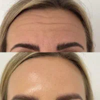 بلک فرایدی کلینیک زیبایی غدیر|خدمات آرایشگری و زیبایی|بروجرد, |دیوار