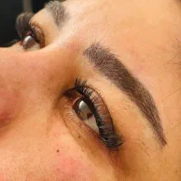 تخفیف ویژه کاشت هیدن