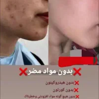 کرم vip تضمینی|آرایشی، بهداشتی، درمانی|رودان, |دیوار