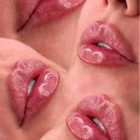 ژل و بوتاکس تخصصی(جشنواره کلینیک)بوتاکس مصپورت ۸۰۰
