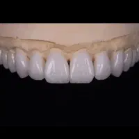 لابراتوار دندانسازی