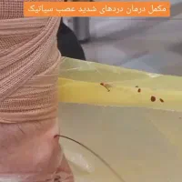 روغن ماساژ،درمان سیاتیک، دیسک، قلنج ،طب سوزنی|خدمات آرایشگری و زیبایی|تبریز, |دیوار