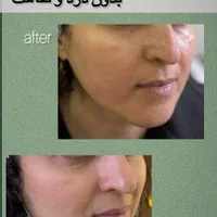 مرکز مراقبت پوست مو لاغری رشت|خدمات آرایشگری و زیبایی|رشت, گلباغ نماز|دیوار