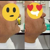 دندان مصنوعی(بدون واسطه خرید کن)|خدمات آرایشگری و زیبایی|قرچک, باقرآباد|دیوار