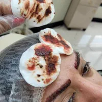 ریمووپاک کردن تتوتاتوابروصورت بدن