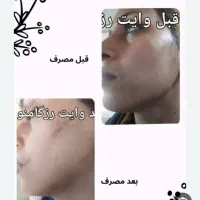 جهت سفارش و محصولات بیشتر پیام بدید