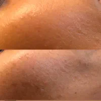 فشیال و پاکسازی تخصصی