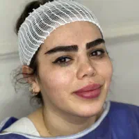 کاشت ابرو به روش جراحی فقط۱۱میلیون