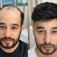 نسخه جدید نجات مو