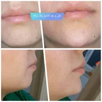 خدمات زیبایی|خدمات آرایشگری و زیبایی|کوهدشت, |دیوار