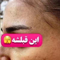 فیشیال وپاکسازی پوست ویژه بانوان|خدمات آرایشگری و زیبایی|سقز, |دیوار