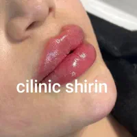 فیلر و بوتاکس .نخ آنزیم کاملا تخصصی