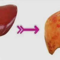 علائم بدنت .رو جدی بگیر