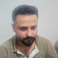 کاشت مو