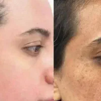 کرم روشن کننده تا ۴ درجه(آقایان،خانم ها)