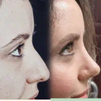 جراحی زیبایی، جشنواره جراحی زیبایی توسط فوق تخصص