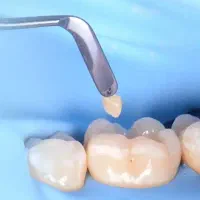 تجهیزات ترمیمی و زیبایی دندانپزشکی  الیت کیور و...