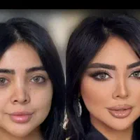 مشاواندام وپوست وموو